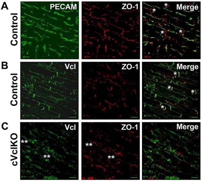 ZO-1 Antibody in Immunohistochemistry (IHC)