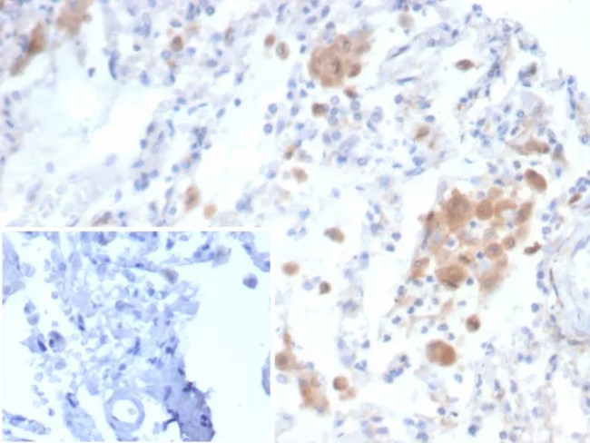CD91/LDL Receptor Related Protein 1 (LRP1) Antibody in Immunohistochemistry (Paraffin) (IHC (P))