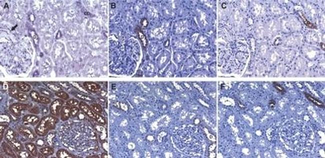 TXNIP Antibody in Immunohistochemistry (IHC)