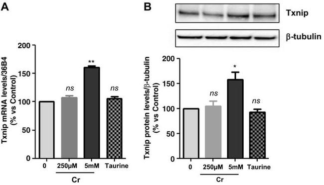 TXNIP Antibody in Western Blot (WB)