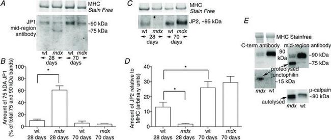 JPH2 Antibody in Western Blot (WB)