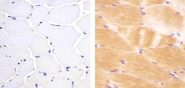 JPH2 Antibody in Immunohistochemistry (Paraffin) (IHC (P))