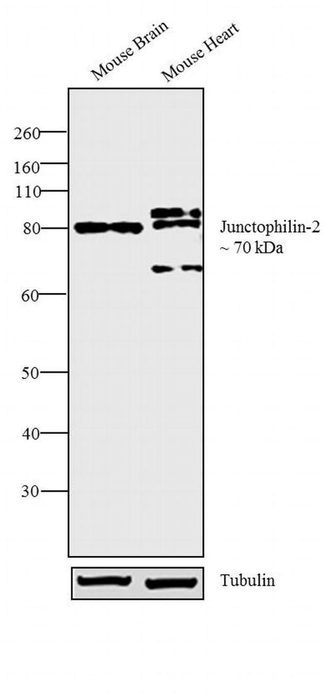 JPH2 Antibody in Western Blot (WB)