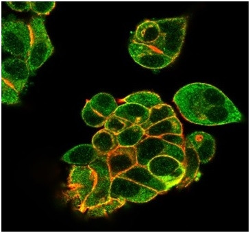 Lactotransferrin/Lactoferrin/LTF Antibody in Immunocytochemistry (ICC/IF)