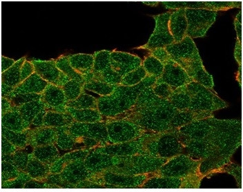 Lactotransferrin/Lactoferrin/LTF Antibody in Immunocytochemistry (ICC/IF)