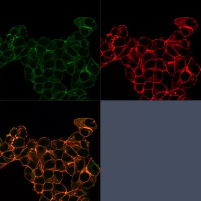 Lactotransferrin/Lactoferrin/LTF Antibody in Immunocytochemistry (ICC/IF)