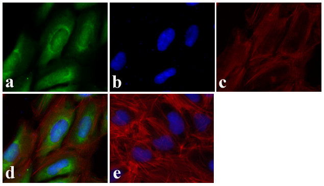 Metadherin Antibody in Immunocytochemistry (ICC/IF)