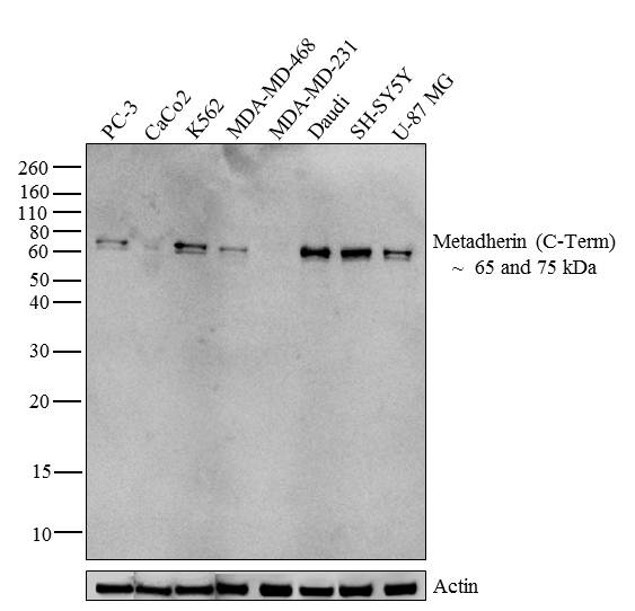 Metadherin Antibody in Western Blot (WB)