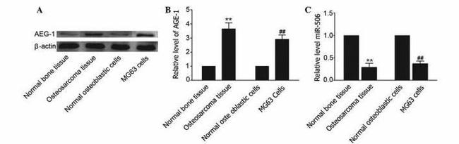 Metadherin Antibody in Western Blot (WB)