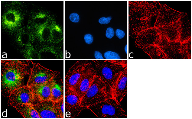 Metadherin Antibody in Immunocytochemistry (ICC/IF)