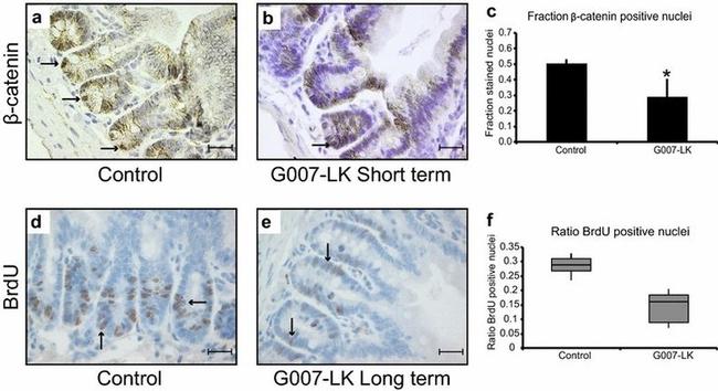 BrdU Antibody in Immunohistochemistry (IHC)