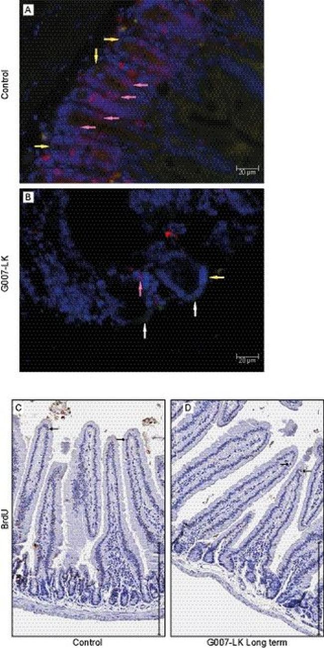 BrdU Antibody in Immunohistochemistry (IHC)