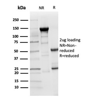 Lysozyme (Histiocytoma andMonocytic Acute Leukemia Marker) Antibody in Immunohistochemistry (Paraffin) (IHC (P))