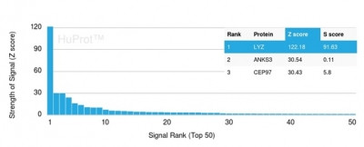 Lysozyme (Histiocytoma andMonocytic Acute Leukemia Marker) Antibody in Peptide array (ARRAY)
