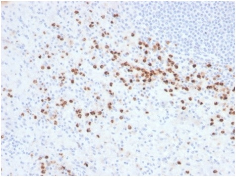 Lysozyme (Histiocytoma andMonocytic Acute Leukemia Marker) Antibody in Immunohistochemistry (Paraffin) (IHC (P))