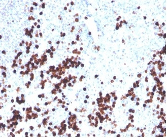 Lysozyme (Histiocytoma and Monocytic Acute Leukemia Marker) Antibody in Immunohistochemistry (Paraffin) (IHC (P))