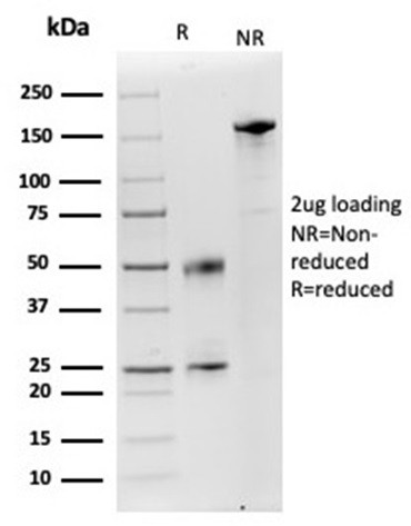 Lysozyme (Histiocytoma and Monocytic Acute Leukemia Marker) Antibody in SDS-PAGE (SDS-PAGE)