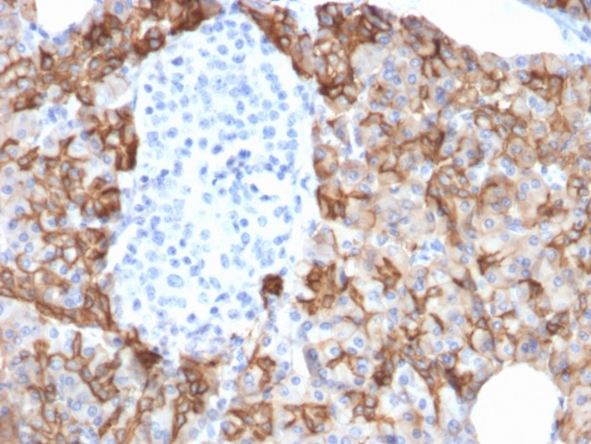 TACSTD2/TROP2 Antibody in Immunohistochemistry (Paraffin) (IHC (P))