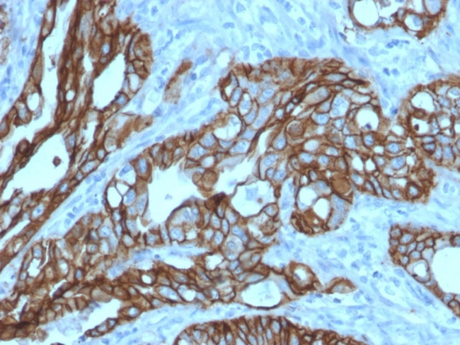 TACSTD2/TROP2 Antibody in Immunohistochemistry (Paraffin) (IHC (P))