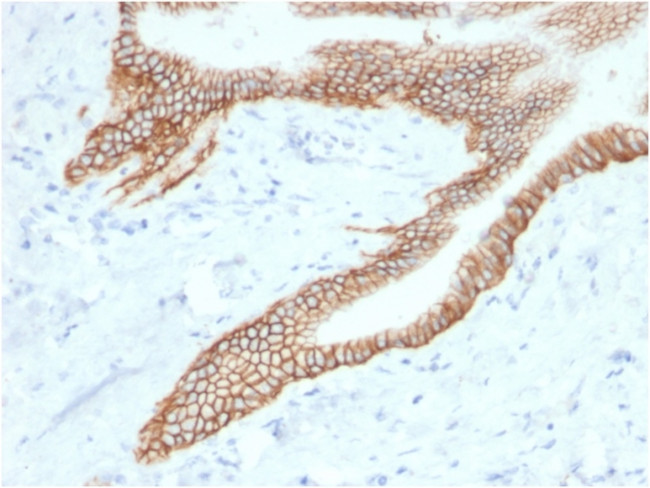 TACSTD2/TROP2 Antibody in Immunohistochemistry (Paraffin) (IHC (P))