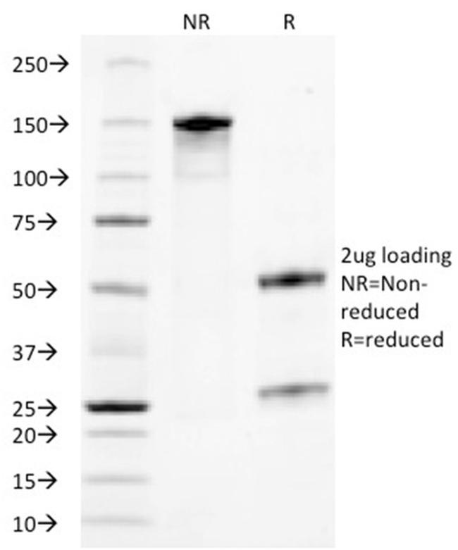 TACSTD2/TROP2 Antibody in SDS-PAGE (SDS-PAGE)