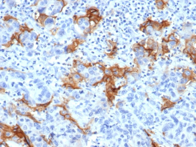 TACSTD2/TROP2 Antibody in Immunohistochemistry (Paraffin) (IHC (P))