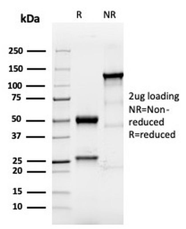 TACSTD2/TROP2 Antibody in SDS-PAGE (SDS-PAGE)