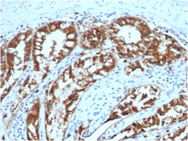 Ep-CAM/CD326 (Extracellular Domain) (Epithelial Marker) Antibody in Immunohistochemistry (Paraffin) (IHC (P))