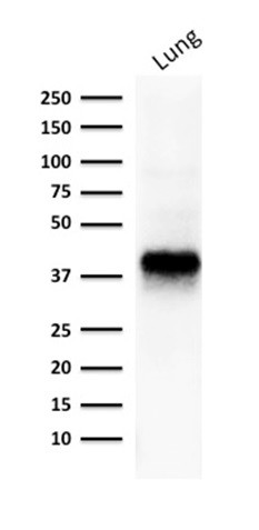 Ep-CAM/CD326 (Extracellular Domain) (Epithelial Marker) Antibody in Western Blot (WB)