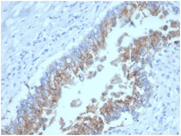 Ep-CAM/CD326 (Extracellular Domain) (Epithelial Marker) Antibody in Immunohistochemistry (Paraffin) (IHC (P))