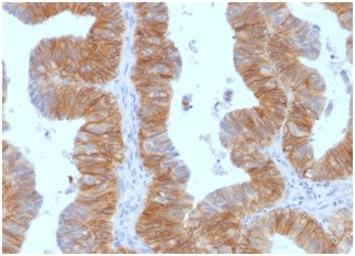 Ep-CAM/CD326 (Extracellular Domain) (Epithelial Marker) Antibody in Immunohistochemistry (Paraffin) (IHC (P))