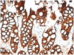 Ep-CAM/CD326 (Extracellular Domain) (Epithelial Marker) Antibody in Immunohistochemistry (Paraffin) (IHC (P))