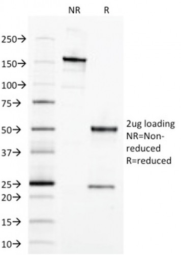 Ep-CAM/CD326 (Extracellular Domain) (Epithelial Marker) Antibody in SDS-PAGE (SDS-PAGE)