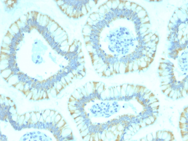 SMAD4 (Pancreatic Adenocarcinoma Marker) Antibody in Immunohistochemistry (Paraffin) (IHC (P))