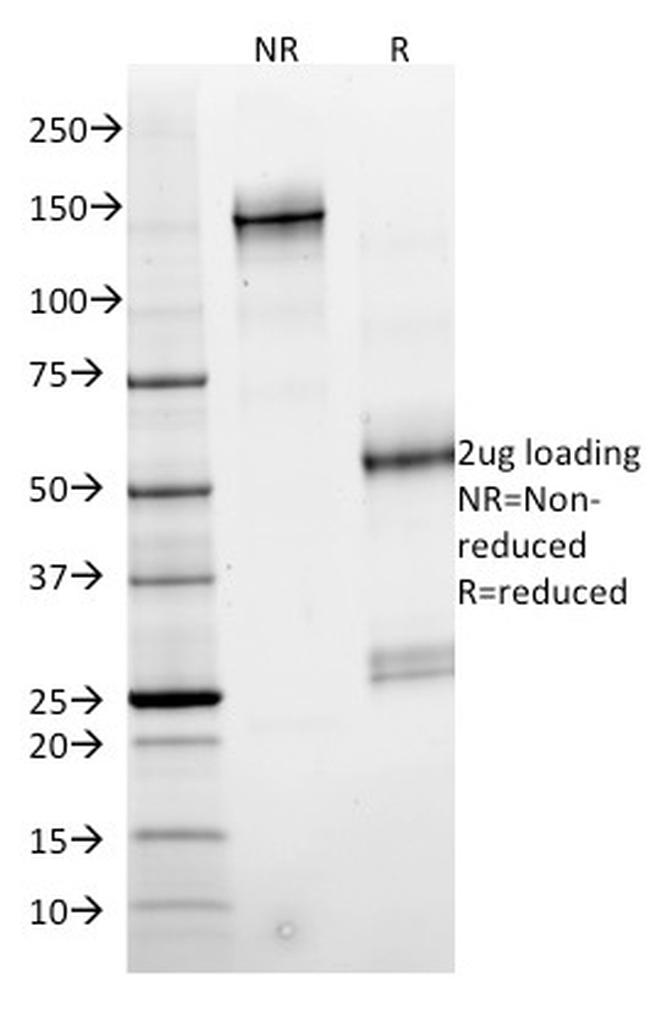 SMAD4 (Pancreatic Adenocarcinoma Marker) Antibody in Immunoelectrophoresis (IE)