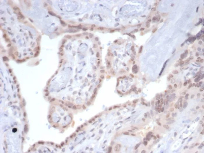 SMAD4 (Pancreatic Adenocarcinoma Marker) Antibody in Immunohistochemistry (Paraffin) (IHC (P))