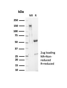 SMAD4/DPC4 (Pancreatic Adenocarcinoma Marker/Tumor Suppressor) Antibody in Immunohistochemistry (IHC)