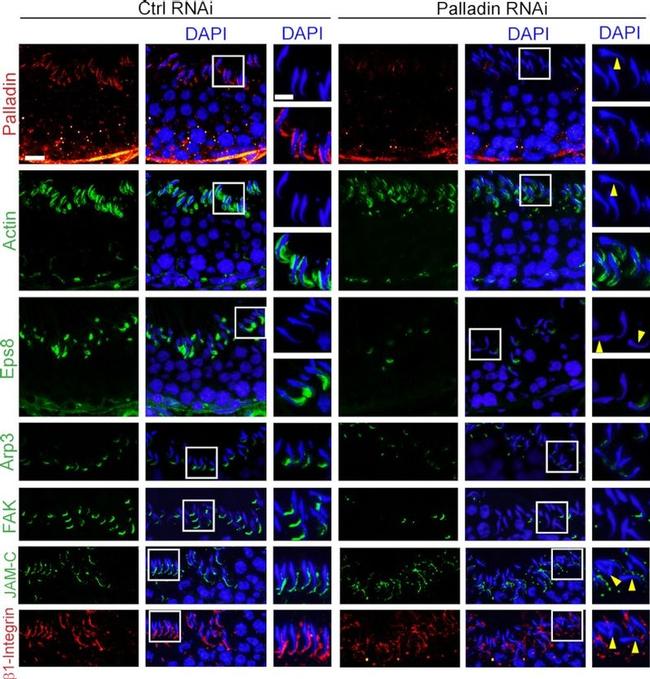 JAM3 Antibody in Immunohistochemistry (IHC)