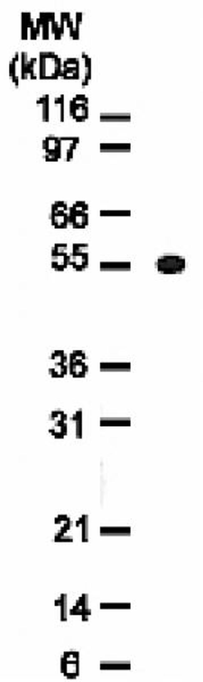 Osteoprotegerin (OPG) Antibody in Western Blot (WB)