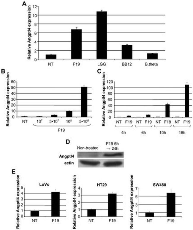 ANGPTL4 Antibody in Western Blot (WB)