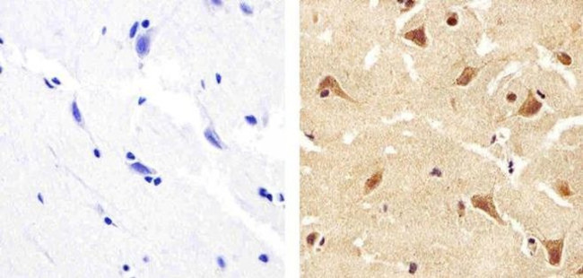 ANGPTL4 Antibody in Immunohistochemistry (Paraffin) (IHC (P))