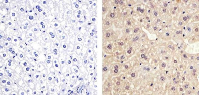 ANGPTL4 Antibody in Immunohistochemistry (Paraffin) (IHC (P))