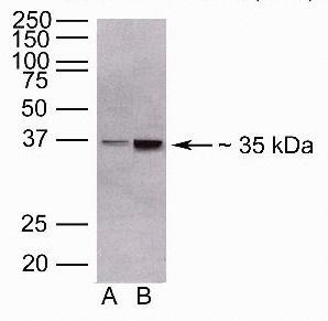 ANGPTL4 Antibody in Western Blot (WB)