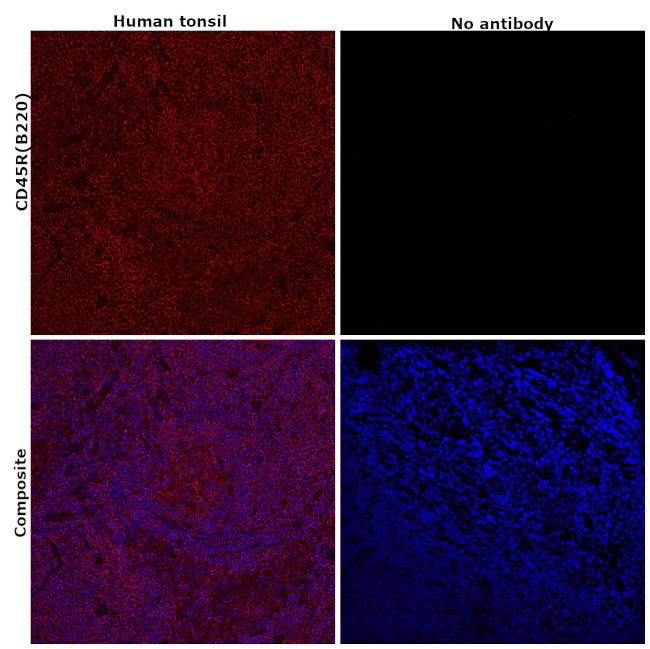 CD45R (B220) Antibody in Immunohistochemistry (Paraffin) (IHC (P))