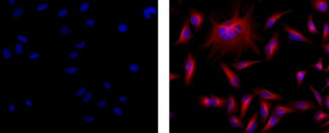 Mouse IgG (H+L) Secondary Antibody in Immunocytochemistry (ICC/IF)