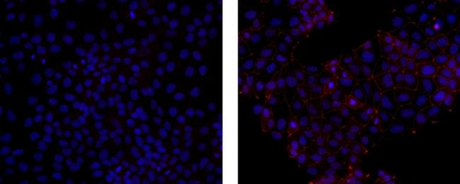 Rat IgG1 kappa Isotype Control in Immunocytochemistry (ICC/IF)