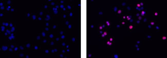 Rat IgG2a kappa Isotype Control in Immunocytochemistry (ICC/IF)