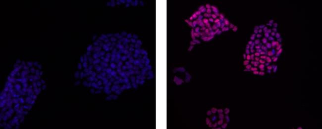 Rat IgG2a kappa Isotype Control in Immunocytochemistry (ICC/IF)