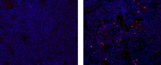 Rat IgG2a kappa Isotype Control in Immunohistochemistry (Paraffin) (IHC (P))