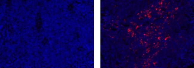 Rat IgG2a kappa Isotype Control in Immunohistochemistry (Paraffin) (IHC (P))